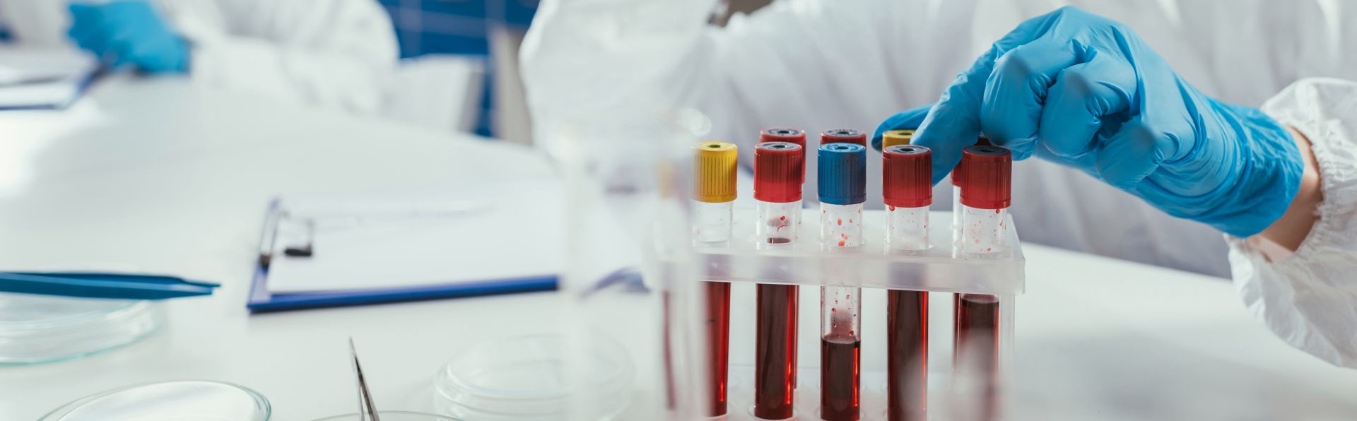 Αιματολογικές Εξετάσεις, Microgen Αθήνα