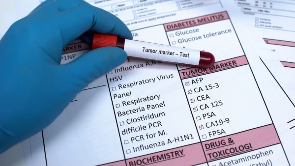 Καρκινικοί δείκτες, microgen, Αθήνα